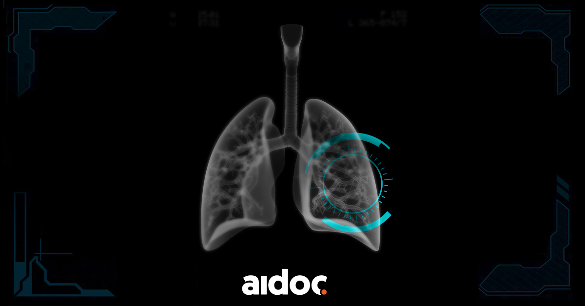 An AI image of lungs